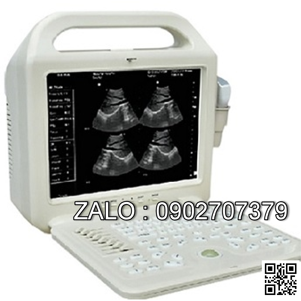 Máy siêu âm ATNL/51353A VET