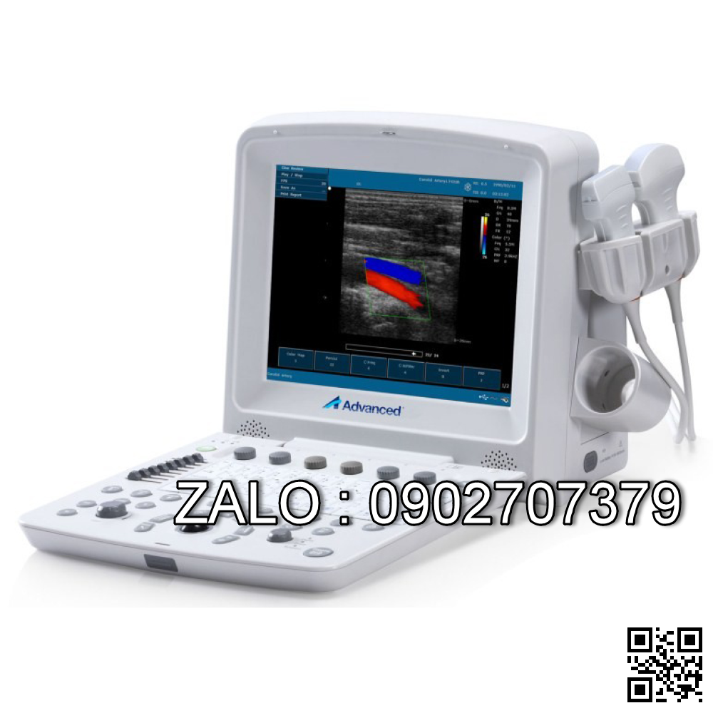 MÁY SIÊU ÂM DOPPLER MÀU DUS-5000