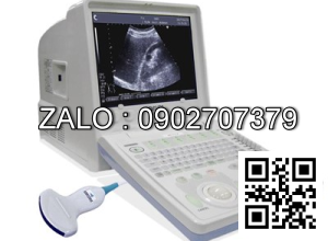 Máy siêu âm đen trắng xách tay Fukuda 400AX