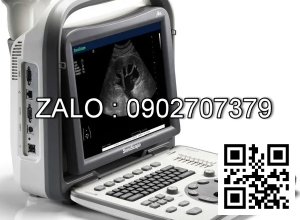 Máy siêu âm xách tay Sonoscape A6