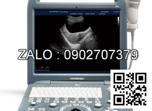 Máy siêu âm 4D xách tay Sonoscape S2