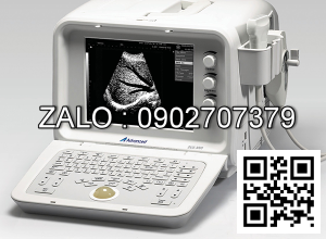 MÁY SIÊU ÂM KỸ THUẬT SỐ DUS-3000