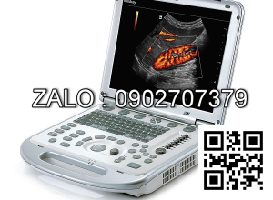Máy siêu âm xách tay 4D Mindray M7