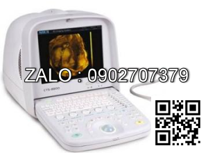 Máy siêu âm 4D xách tay Siui CTS-8800