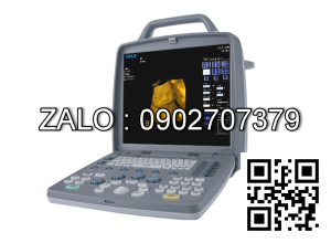 Máy siêu âm 4D xách tay Siui CTS-8800 Plus