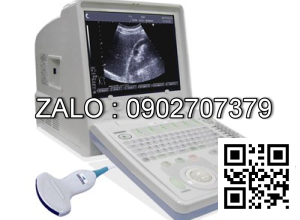 Máy siêu âm đen trắng xách tay Fukuda 400AX