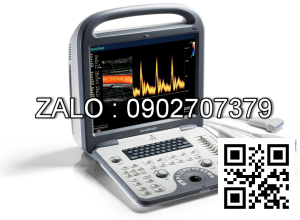 Máy siêu âm 3D Dopler màu Sonoscape S6