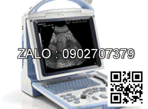 Máy siêu âm nền màu Xukang XK-21355