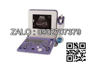 Máy siêu âm xách tay Aloka Prosound 2