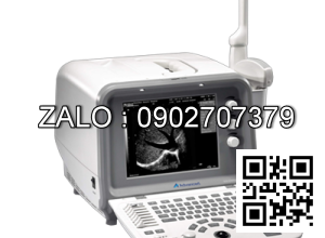 Máy siêu âm trắng đen xách tay DUS-3000 Plus